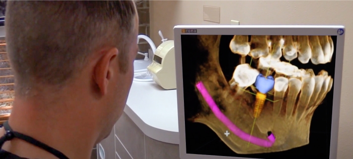 Dental Implants